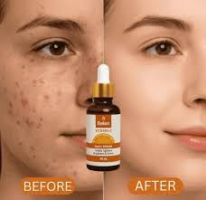 Relax Vitamin C Face Serum – Brighten, Tighten & Glow Naturally! Buy 1 and Get 1 Free